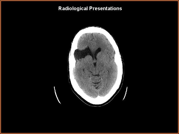 Radiological Presentations 