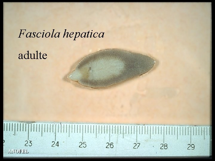 Fasciola hepatica adulte 