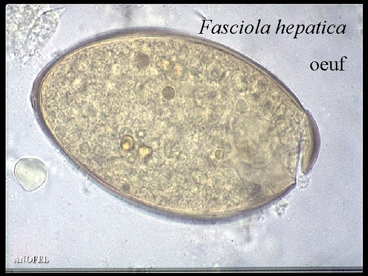 Fasciola hepatica oeuf 