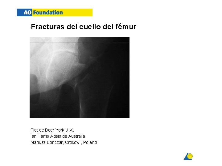 Fracturas del cuello del fémur Piet de Boer York U. K. Ian Harris Adelaide