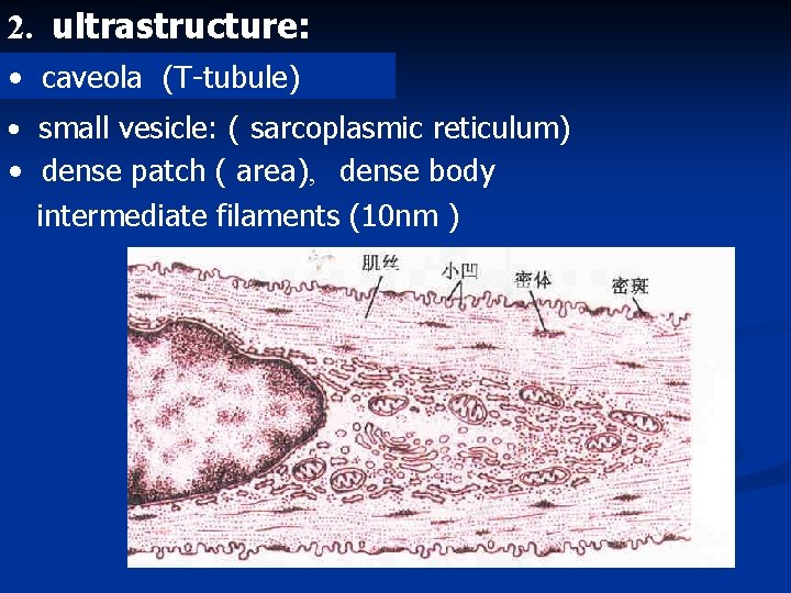 Chapter 6 muscle tissue introduction Composition muscle cellloose