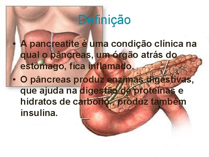 Definição • A pancreatite é uma condição clínica na qual o pâncreas, um órgão