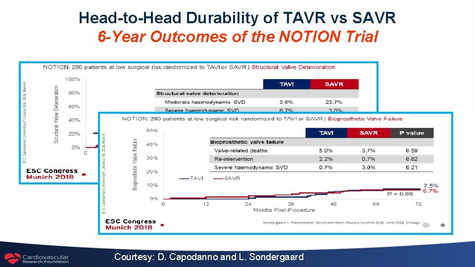 Head-to-Head Durability of TAVR vs SAVR 6 -Year Outcomes of the NOTION Trial Courtesy:
