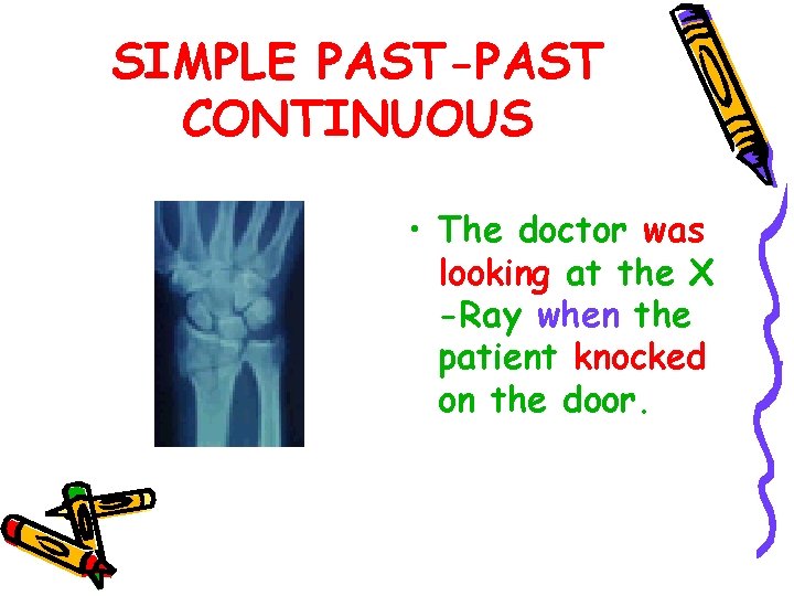 SIMPLE PAST-PAST CONTINUOUS • The doctor was looking at the X -Ray when the