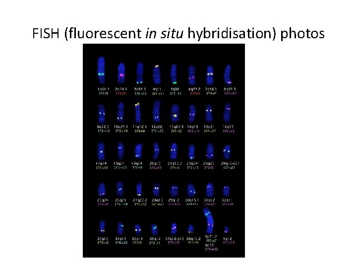 FISH (fluorescent in situ hybridisation) photos 
