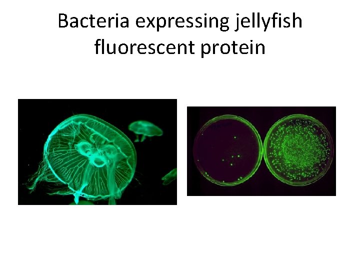 Bacteria expressing jellyfish fluorescent protein 