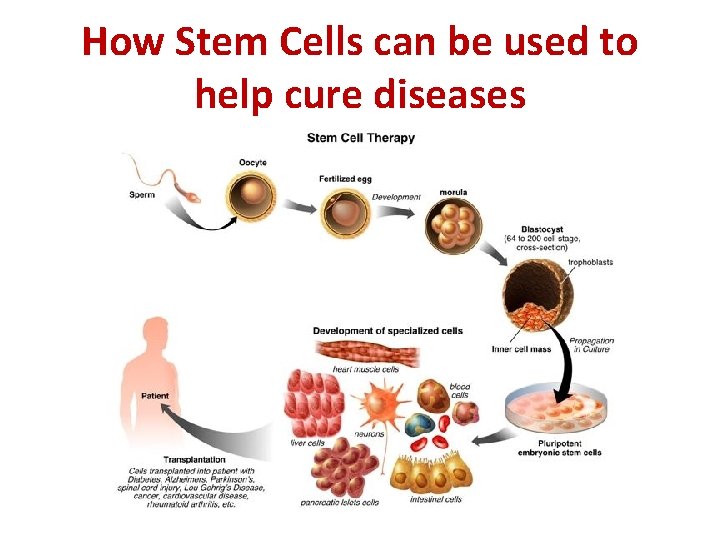 How Stem Cells can be used to help cure diseases 