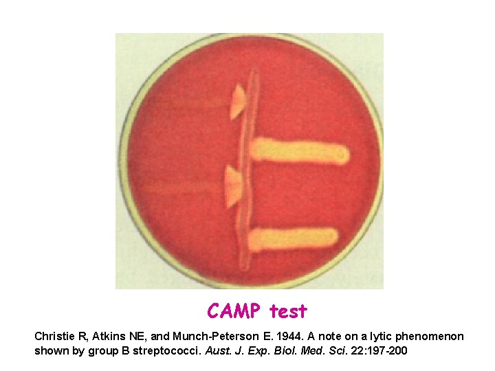 CAMP test Christie R, Atkins NE, and Munch-Peterson E. 1944. A note on a