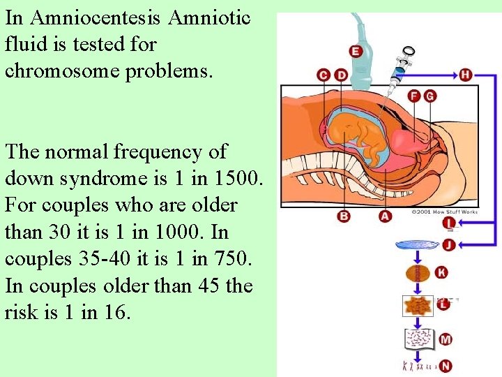 In Amniocentesis Amniotic fluid is tested for chromosome problems. The normal frequency of down