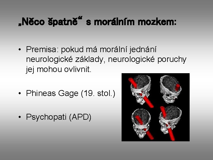 „Něco špatně“ s morálním mozkem: • Premisa: pokud má morální jednání neurologické základy, neurologické