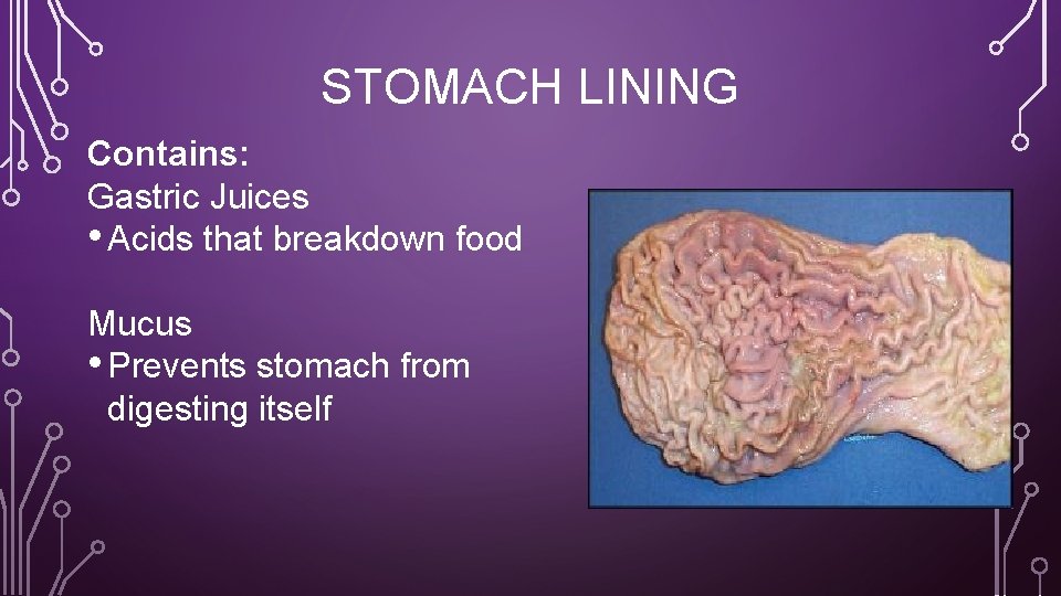 STOMACH LINING Contains: Gastric Juices • Acids that breakdown food Mucus • Prevents stomach