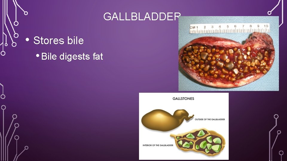 GALLBLADDER • Stores bile • Bile digests fat 