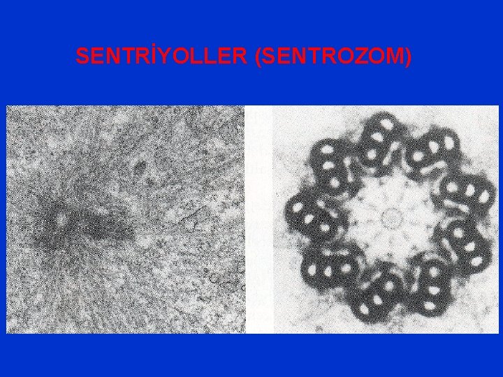 SENTRİYOLLER (SENTROZOM) 