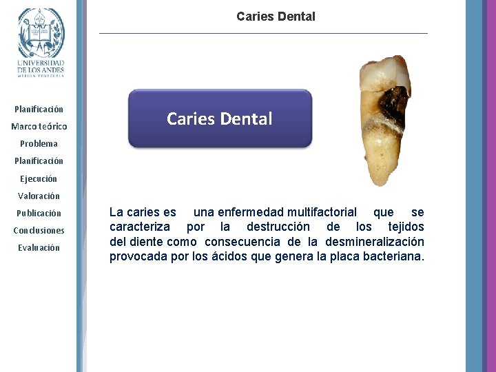 Caries Dental Planificación Marco teórico Caries Dental Problema Planificación Ejecución Valoración Publicación Conclusiones Evaluación
