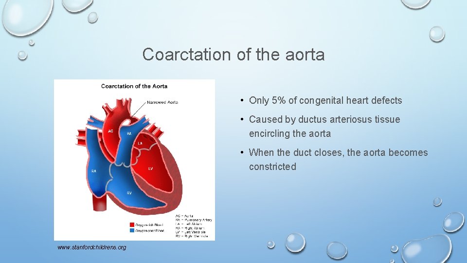 Coarctation of the aorta • Only 5% of congenital heart defects • Caused by