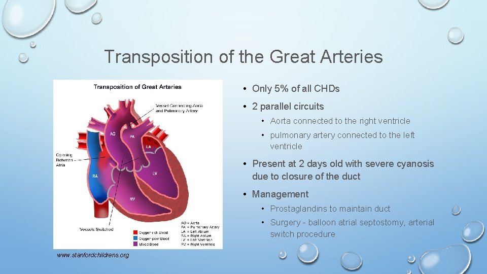 Transposition of the Great Arteries • Only 5% of all CHDs • 2 parallel