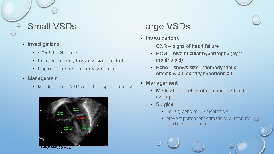 Small VSDs • Investigations: • CXR & ECG normal • Echocardiography to assess size