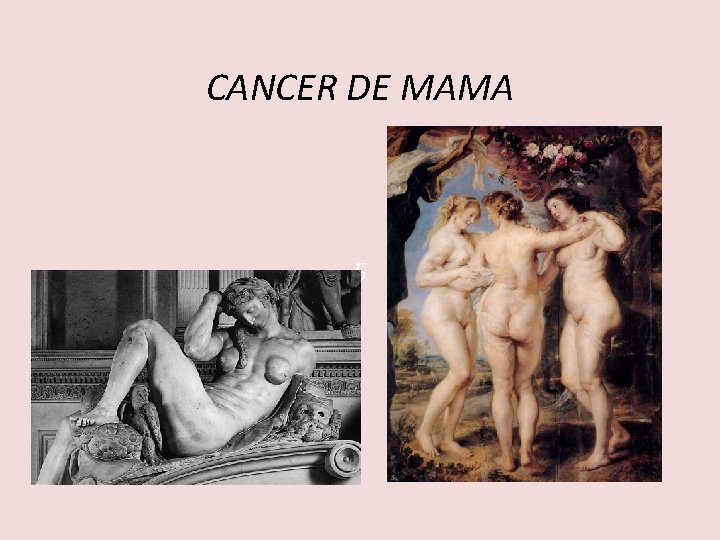 CANCER DE MAMA 5 