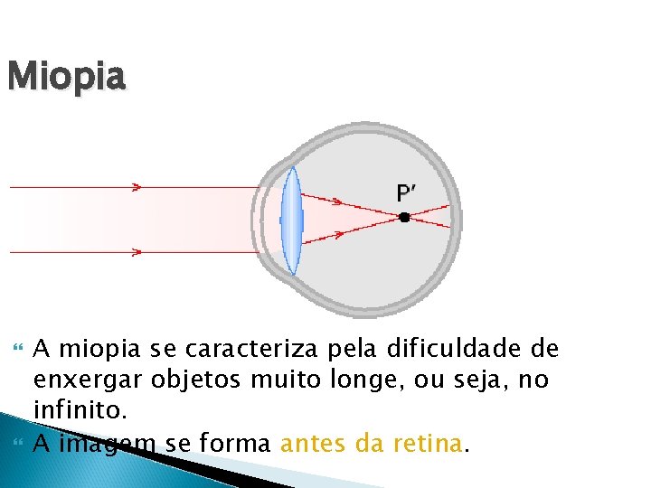 Miopia A miopia se caracteriza pela dificuldade de enxergar objetos muito longe, ou seja,