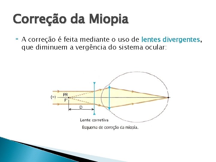 Correção da Miopia A correção é feita mediante o uso de lentes divergentes, que
