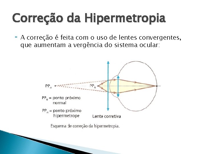 Correção da Hipermetropia A correção é feita com o uso de lentes convergentes, que