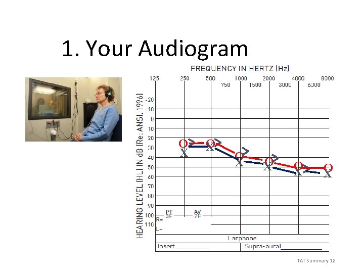 1. Your Audiogram O X O X O X TAT Summary 18 