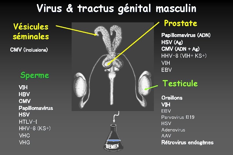 Virus & tractus génital masculin Vésicules séminales CMV (inclusions) Sperme VIH HBV CMV Papillomavirus