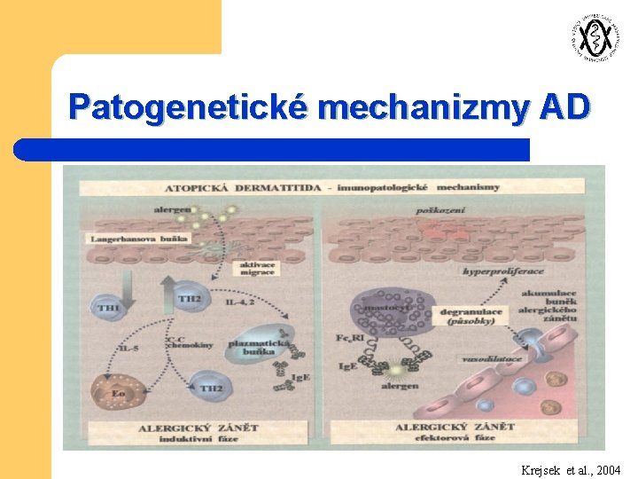 Patogenetické mechanizmy AD Krejsek et al. , 2004 