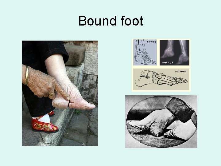 Bound foot 