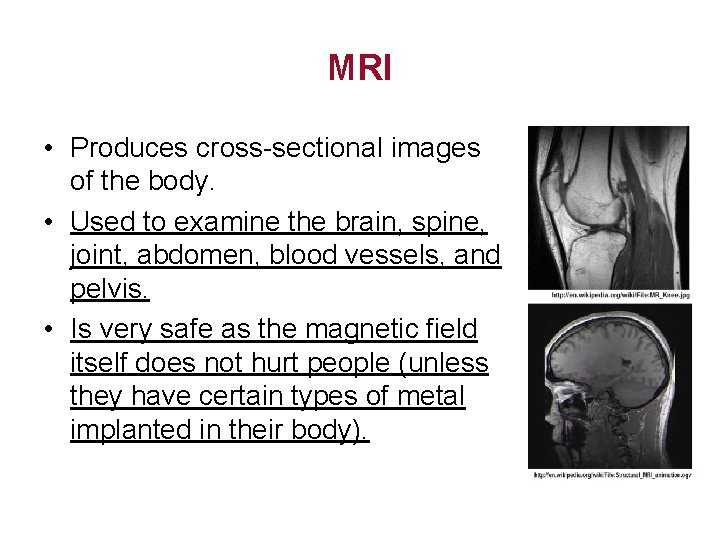 MRI • Produces cross-sectional images of the body. • Used to examine the brain,