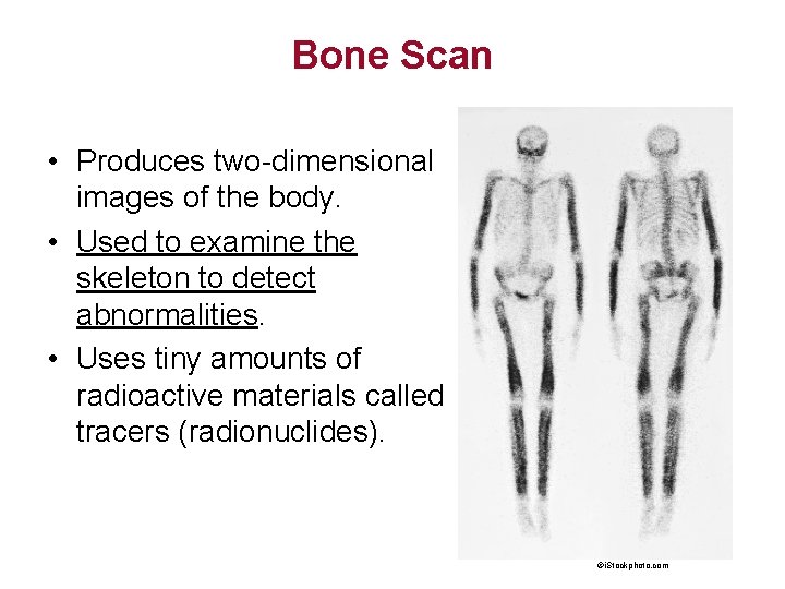 Bone Scan • Produces two-dimensional images of the body. • Used to examine the