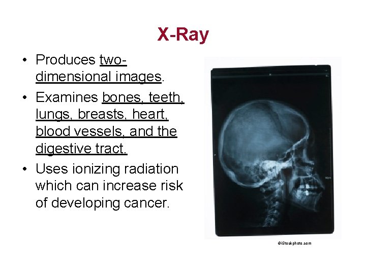 X-Ray • Produces twodimensional images. • Examines bones, teeth, lungs, breasts, heart, blood vessels,