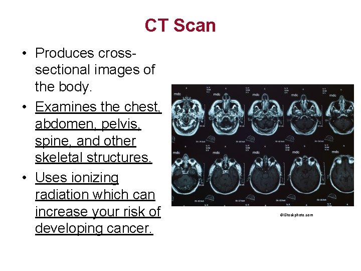 CT Scan • Produces crosssectional images of the body. • Examines the chest, abdomen,