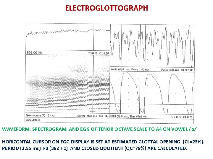 ELECTROGLOTTOGRAPH WAVEFORM, SPECTROGRAM, AND EGG OF TENOR OCTAVE SCALE TO A 4 ON VOWEL