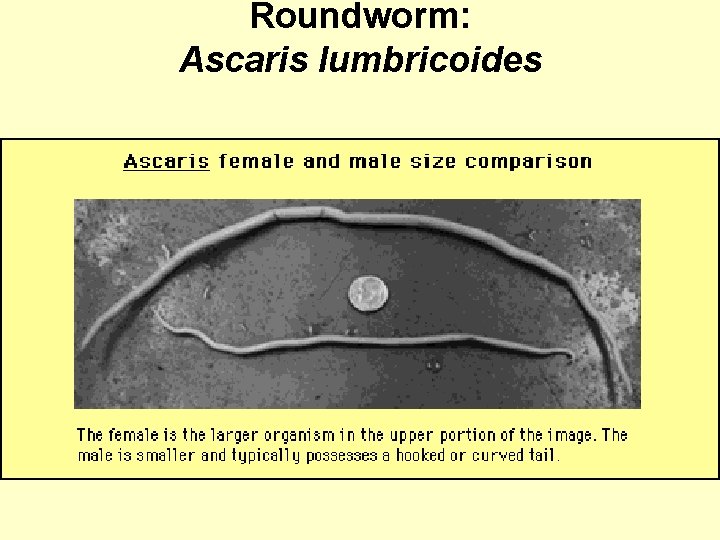 Roundworm: Ascaris lumbricoides 