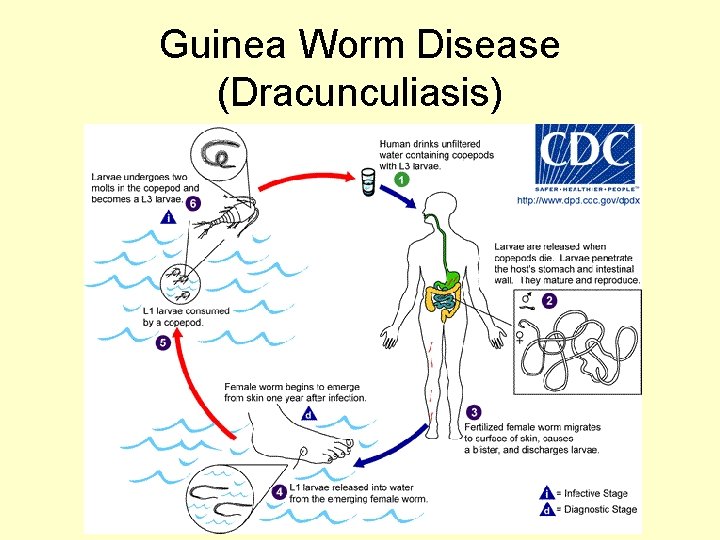 Guinea Worm Disease (Dracunculiasis) 