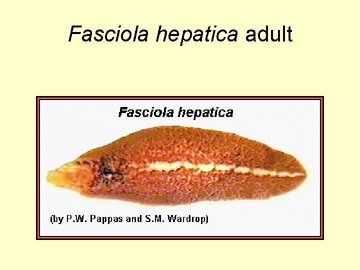 Fasciola hepatica adult 