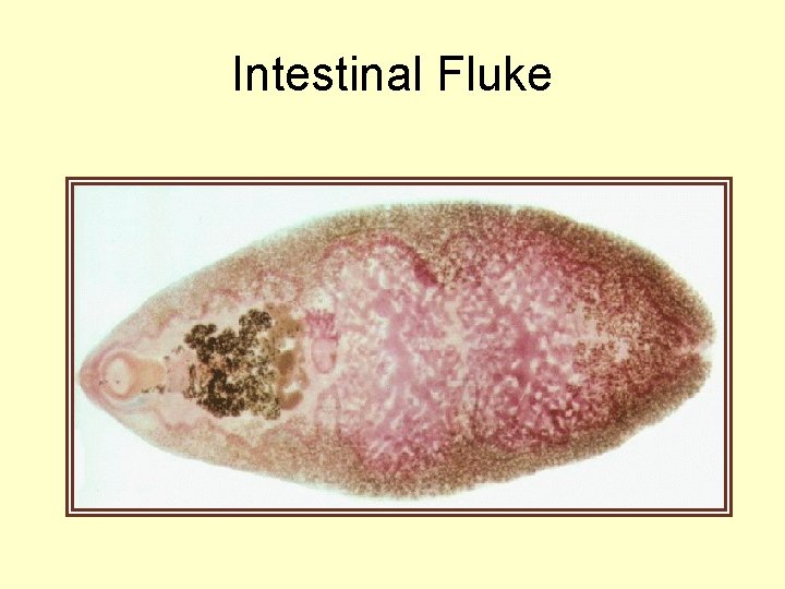 Intestinal Fluke 