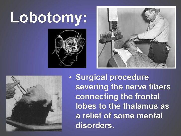 Lobotomy: • Surgical procedure severing the nerve fibers connecting the frontal lobes to the