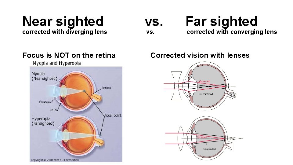 Near sighted corrected with diverging lens Focus is NOT on the retina vs. Far