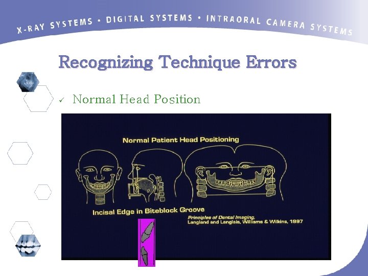 Recognizing Technique Errors ü Normal Head Position 