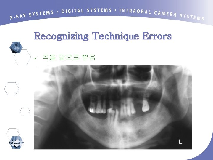 Recognizing Technique Errors ü 목을 앞으로 뻗음 