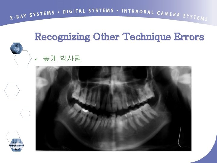 Recognizing Other Technique Errors ü 높게 방사됨 