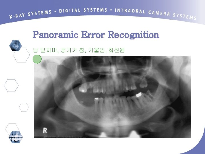 Panoramic Error Recognition 납 앞치마, 공기가 참, 기울임, 회전됨 