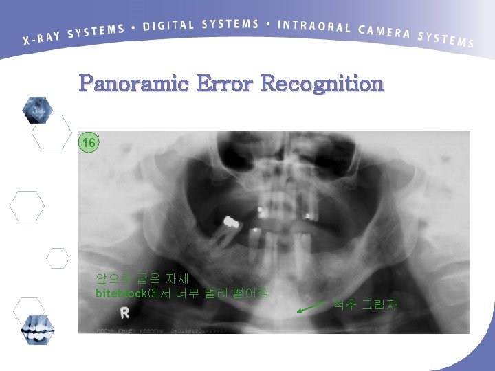 Panoramic Error Recognition 16 앞으로 굽은 자세 biteblock에서 너무 멀리 떨어짐 척추 그림자 