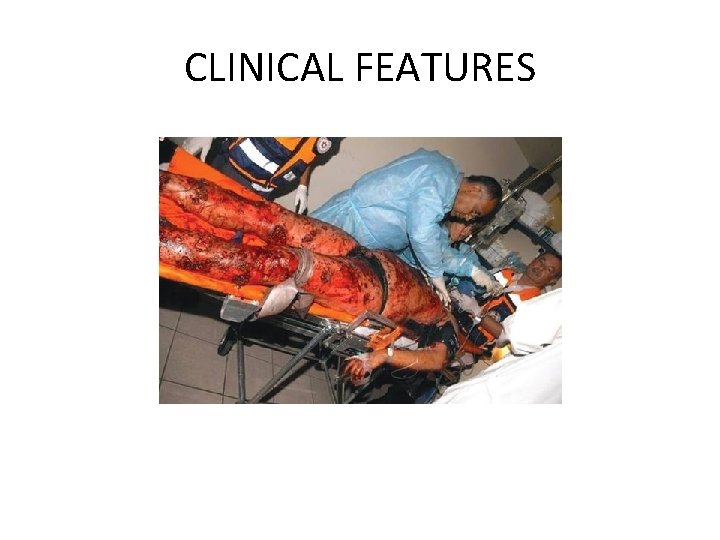 CLINICAL FEATURES 