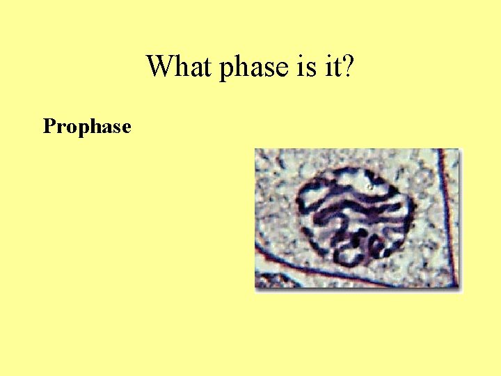 What phase is it? Prophase What phase is it? Prophase