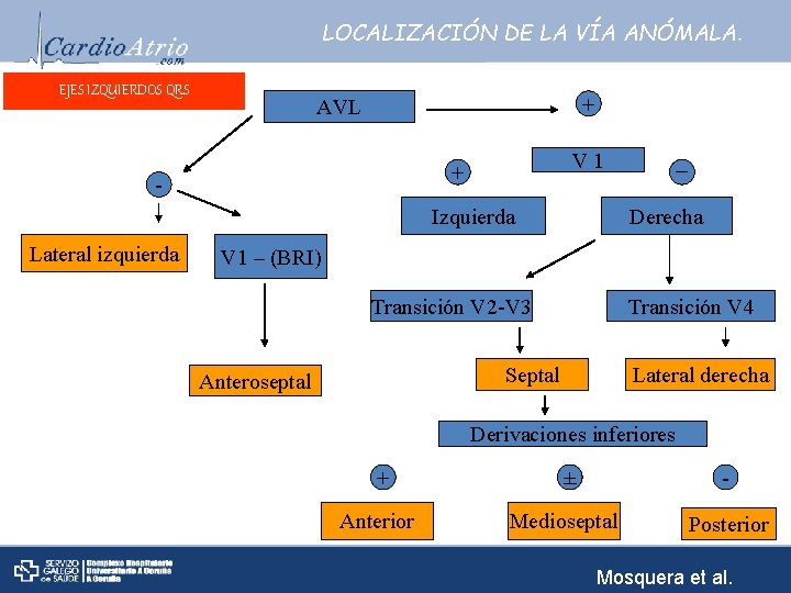 LOCALIZACIÓN DE LA VÍA ANÓMALA. EJES IZQUIERDOS QRS + AVL V 1 + -