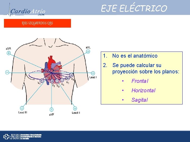 EJE ELÉCTRICO EJES IZQUIERDOS QRS 1. No es el anatómico 2. Se puede calcular