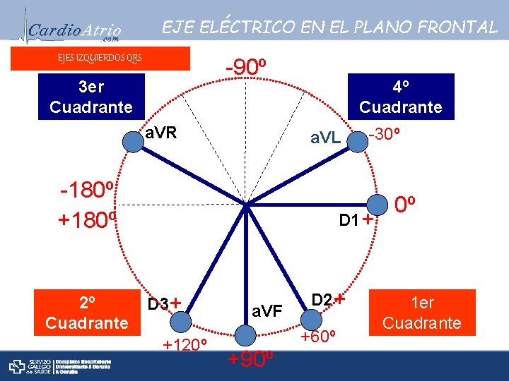 EJE ELÉCTRICO EN EL PLANO FRONTAL EJES IZQUIERDOS QRS -90º 3 er Cuadrante a.